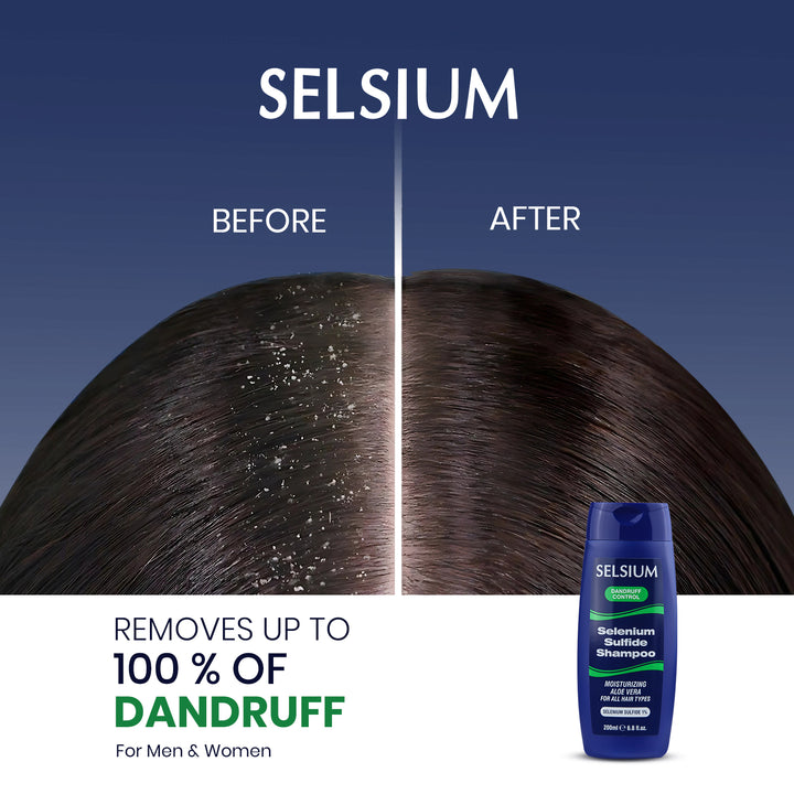 Selsium Sulfide Shampoo